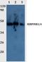 Serpin Family B Member 3 antibody, A04067-1, Boster Biological Technology, Western Blot image 