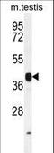 Inhibin Subunit Beta B antibody, LS-C165242, Lifespan Biosciences, Western Blot image 