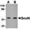 SKI Like Proto-Oncogene antibody, orb74407, Biorbyt, Western Blot image 