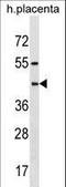 Pregnancy Specific Beta-1-Glycoprotein 6 antibody, LS-C158746, Lifespan Biosciences, Western Blot image 