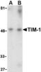 Hepatitis A Virus Cellular Receptor 1 antibody, AHP1187, Bio-Rad (formerly AbD Serotec) , Western Blot image 