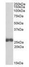 Rho GDP Dissociation Inhibitor Beta antibody, orb20614, Biorbyt, Western Blot image 