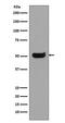 Immunoglobulin Heavy Constant Gamma 4 (G4m Marker) antibody, M11385-1, Boster Biological Technology, Western Blot image 