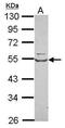 Tryptophanyl-TRNA Synthetase antibody, PA5-29849, Invitrogen Antibodies, Western Blot image 