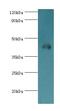 NCK Adaptor Protein 1 antibody, LS-C376206, Lifespan Biosciences, Western Blot image 