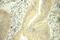 Mitochondrial Trans-2-Enoyl-CoA Reductase antibody, 51025-2-Ig, Proteintech Group, Immunohistochemistry paraffin image 