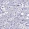 Cystatin SA antibody, HPA043706, Atlas Antibodies, Immunohistochemistry paraffin image 