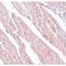 Transmembrane Protein 184C antibody, LS-C108696, Lifespan Biosciences, Immunohistochemistry paraffin image 