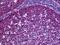 Mucin 5AC, Oligomeric Mucus/Gel-Forming antibody, orb94839, Biorbyt, Immunohistochemistry paraffin image 