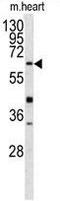 Gamma-Glutamyltransferase 5 antibody, GTX81477, GeneTex, Western Blot image 