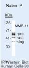 Matrix Metallopeptidase 11 antibody, MA5-11231, Invitrogen Antibodies, Immunoprecipitation image 