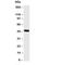 S-Phase Kinase Associated Protein 2 antibody, R30268, NSJ Bioreagents, Western Blot image 