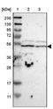 Interleukin 18 Receptor 1 antibody, NBP1-85782, Novus Biologicals, Western Blot image 