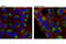 Receptor-binding cancer antigen expressed on SiSo cells antibody, 12290S, Cell Signaling Technology, Immunofluorescence image 
