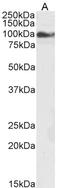 Transient Receptor Potential Cation Channel Subfamily C Member 6 antibody, LS-C55631, Lifespan Biosciences, Western Blot image 