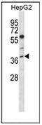 Nei Like DNA Glycosylase 2 antibody, AP52850PU-N, Origene, Immunohistochemistry frozen image 