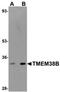 Transmembrane Protein 38B antibody, orb75325, Biorbyt, Western Blot image 