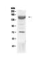 Insulin Like Growth Factor 1 Receptor antibody, PA5-79445, Invitrogen Antibodies, Western Blot image 