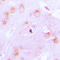 Cyp17 antibody, LS-C352100, Lifespan Biosciences, Immunohistochemistry frozen image 