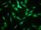 Kinesin Family Member 22 antibody, LS-C675139, Lifespan Biosciences, Immunofluorescence image 