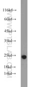 Interleukin-18 antibody, 10663-1-AP, Proteintech Group, Western Blot image 