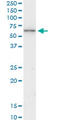 Keratin 6B antibody, LS-C197588, Lifespan Biosciences, Western Blot image 