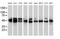 Protein kinase C and casein kinase substrate in neurons protein 3 antibody, MA5-25367, Invitrogen Antibodies, Western Blot image 