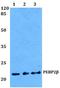 Core-Binding Factor Subunit Beta antibody, A01007-2, Boster Biological Technology, Western Blot image 