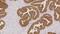 Kallikrein Related Peptidase 3 antibody, GTX01887, GeneTex, Immunohistochemistry paraffin image 