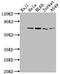 Protein Arginine Methyltransferase 5 antibody, CSB-RA176962A0HU, Cusabio, Western Blot image 