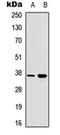 RAD51 Recombinase antibody, orb315675, Biorbyt, Western Blot image 
