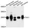 Thy-1 Cell Surface Antigen antibody, A2126, ABclonal Technology, Western Blot image 