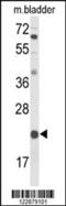 DiGeorge Syndrome Critical Region Gene 6 antibody, 64-024, ProSci, Western Blot image 