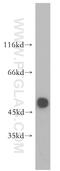 Glycine Receptor Alpha 1 antibody, 17951-1-AP, Proteintech Group, Western Blot image 