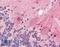 Sirtuin 2 antibody, LS-B3222, Lifespan Biosciences, Immunohistochemistry paraffin image 