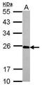 Interleukin 17C antibody, PA5-34860, Invitrogen Antibodies, Western Blot image 