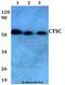 Dipeptidyl peptidase 1 antibody, A02136, Boster Biological Technology, Western Blot image 