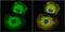 Stathmin 1 antibody, GTX104707, GeneTex, Immunofluorescence image 