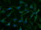 Uridine-Cytidine Kinase 1 antibody, GTX83442, GeneTex, Immunofluorescence image 