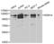 Lysine Demethylase 1A antibody, abx001070, Abbexa, Western Blot image 