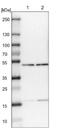 Protein Phosphatase 2 Phosphatase Activator antibody, NBP1-87232, Novus Biologicals, Western Blot image 