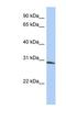 Zinc Finger FYVE-Type Containing 28 antibody, NBP1-79390, Novus Biologicals, Western Blot image 