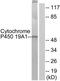 Cytochrome P450 Family 19 Subfamily A Member 1 antibody, TA311724, Origene, Western Blot image 