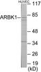 G Protein-Coupled Receptor Kinase 2 antibody, EKC1696, Boster Biological Technology, Western Blot image 