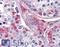 Cathepsin K antibody, LS-B2531, Lifespan Biosciences, Immunohistochemistry frozen image 