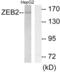 Zinc Finger E-Box Binding Homeobox 2 antibody, abx013303, Abbexa, Western Blot image 