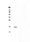 NPC Intracellular Cholesterol Transporter 2 antibody, A01582-2, Boster Biological Technology, Western Blot image 