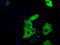 Transforming Acidic Coiled-Coil Containing Protein 3 antibody, LS-C115278, Lifespan Biosciences, Immunofluorescence image 