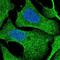 IKBKB Interacting Protein antibody, NBP1-92022, Novus Biologicals, Immunocytochemistry image 