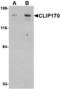 CAP-Gly Domain Containing Linker Protein 1 antibody, A08907, Boster Biological Technology, Western Blot image 